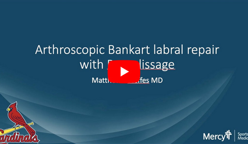 Anterior Labral Repair