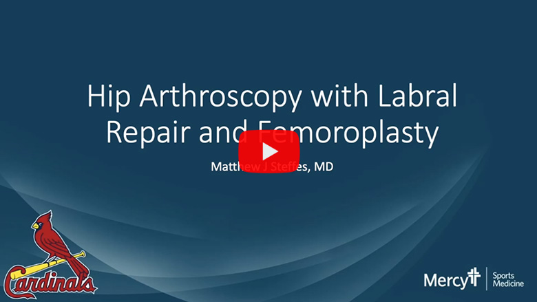 Hip Arthroscopy with Labral Repair and Femoroplasty