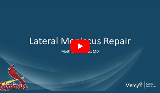 Lateral Meniscus Repair