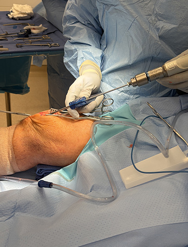 Patellar and Quad Tendon Repair
