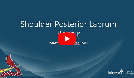 Shoulder Posterior Labrum Repair img